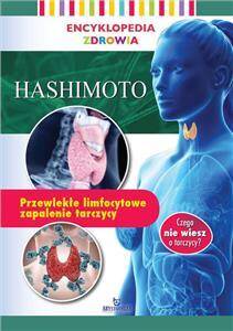 Encyklopedia zdrowia. Hashimoto